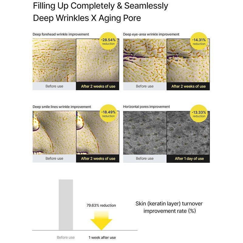 Retinol Essence Serum for Retinol Eye Cream Eye Cream Essence - GlowNordi 